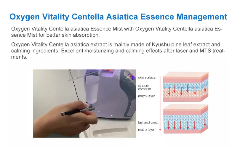 Oxygen Facial Machine