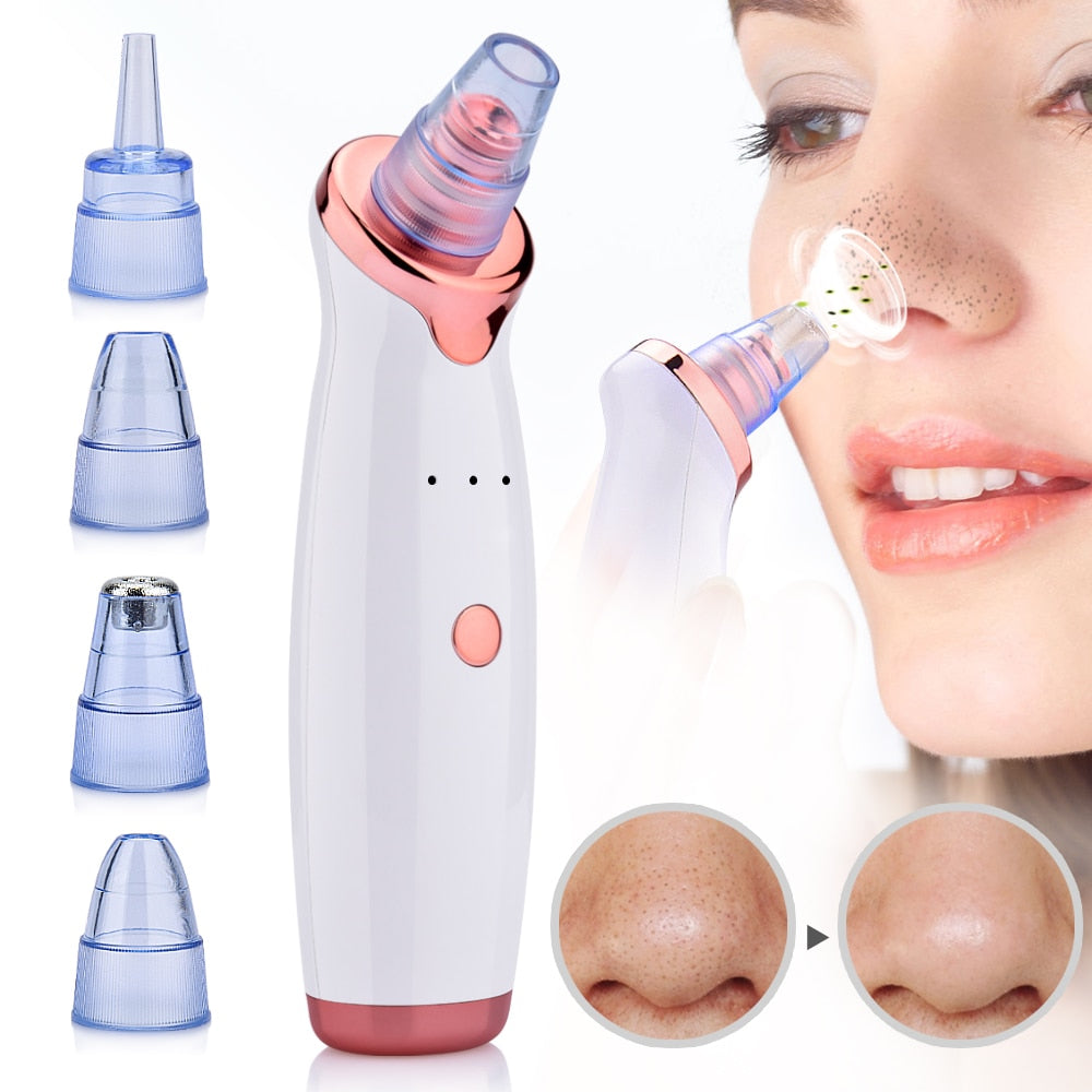 Facial Deep Pore Blackhead Remover - MybeautySync