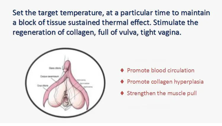 Thermiva Fractional RF Vaginal  Rejuvenation Machine