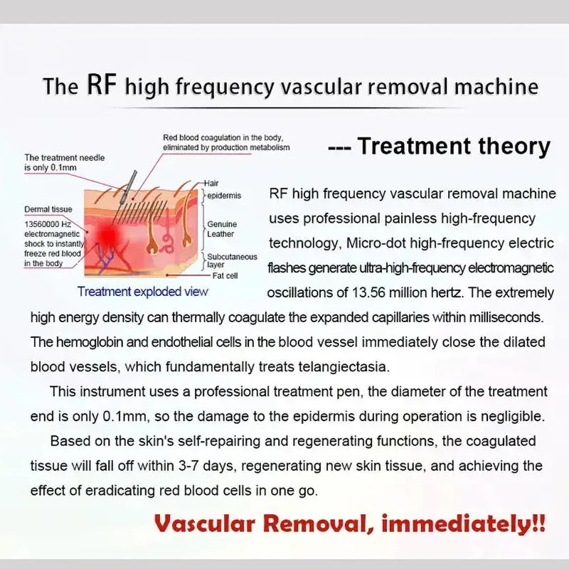 RF High Frequency Vascular Removal Machine