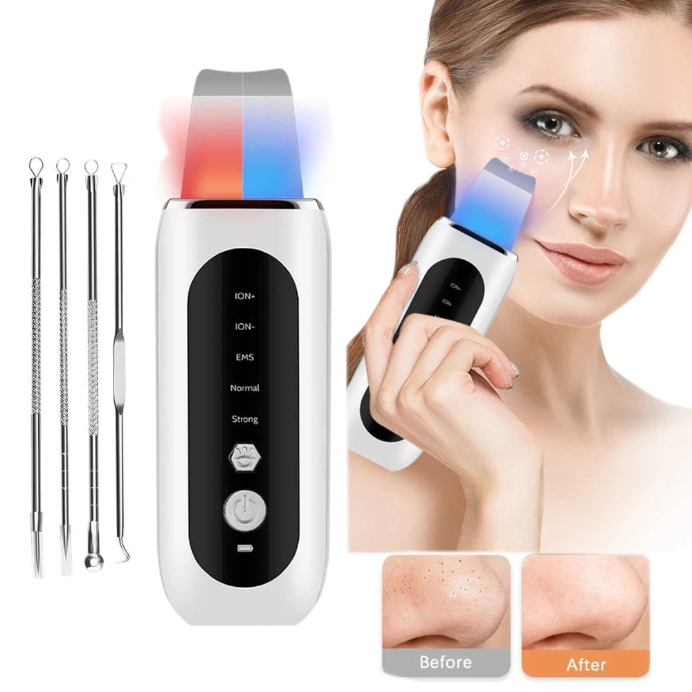 Ultrasonic Ion Skin Cleaner