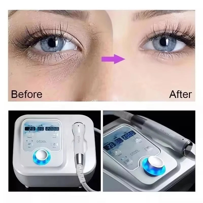 Portable DCool Electroporation Facial  Machine