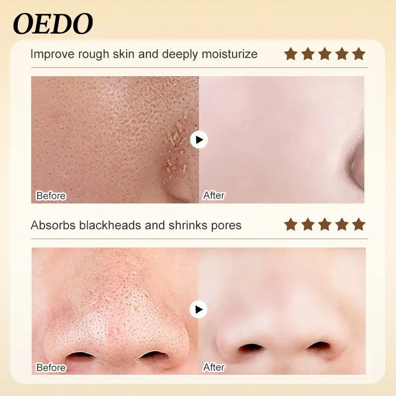 OEDO Gold Blackhead Face Mask