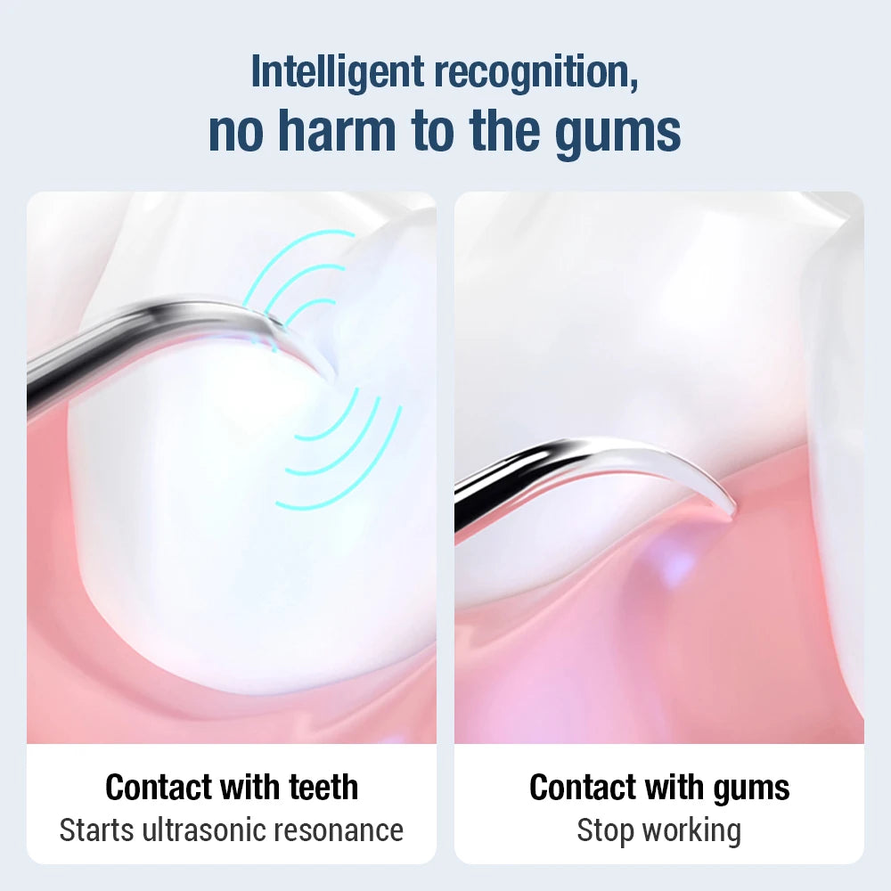 Ultrasonic Electric Tooth Scaler