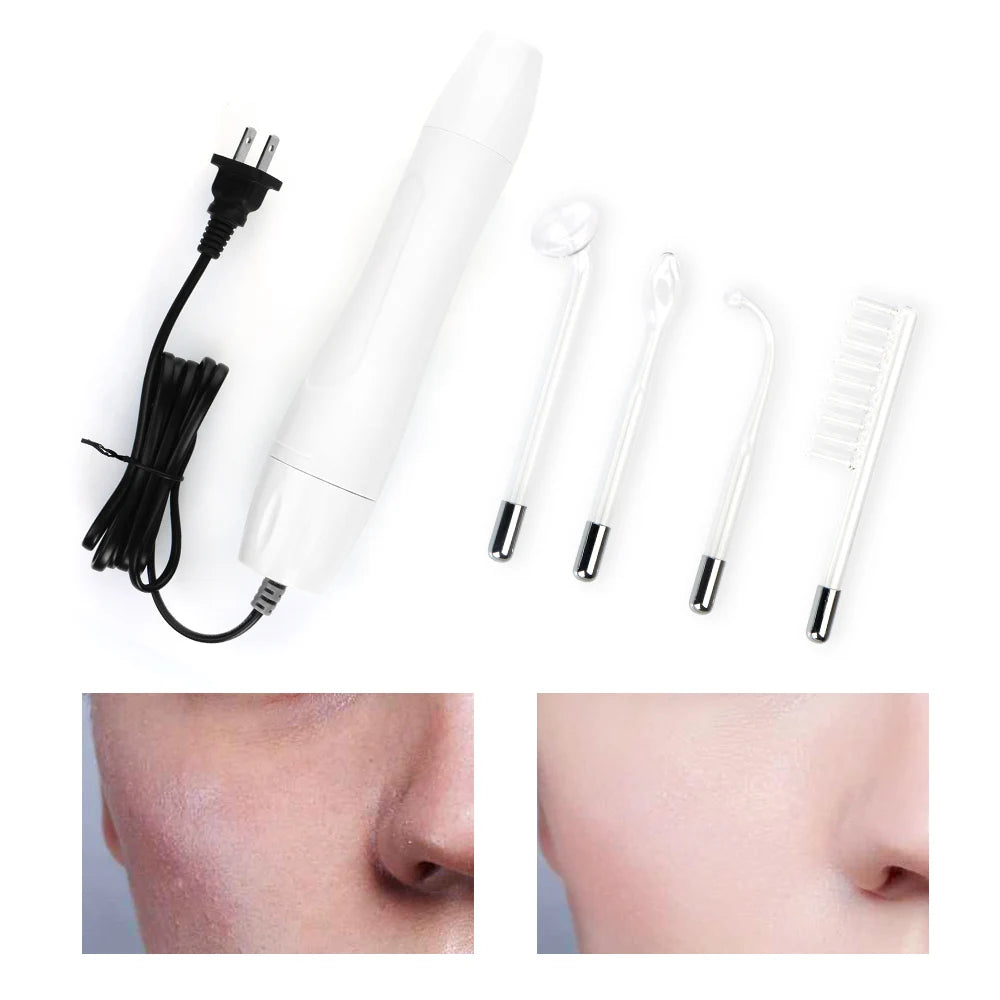 4-in-1 High-Frequency Wand