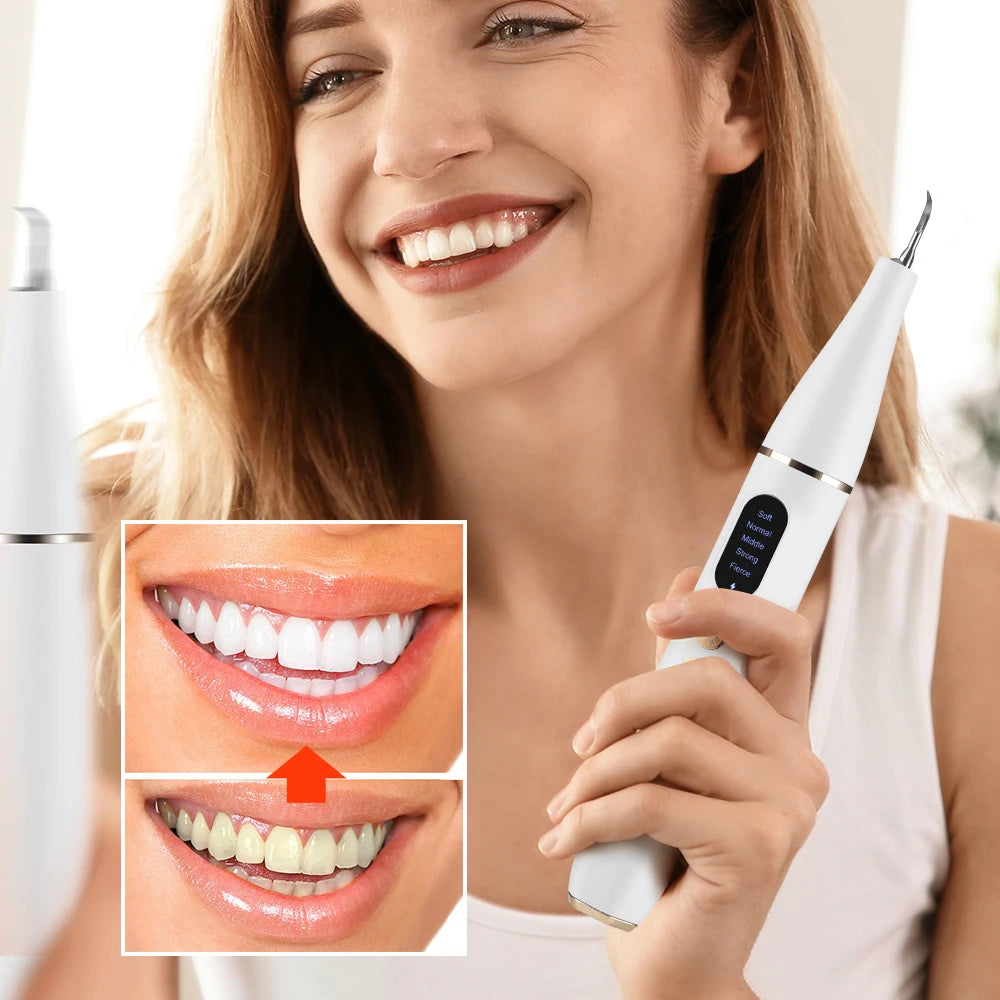 Ultrasonic Electric Tooth Scaler