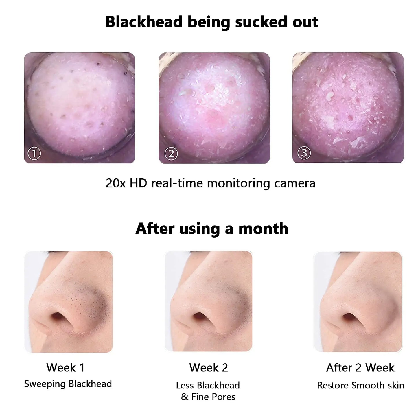 Visual Blackhead Remover Device