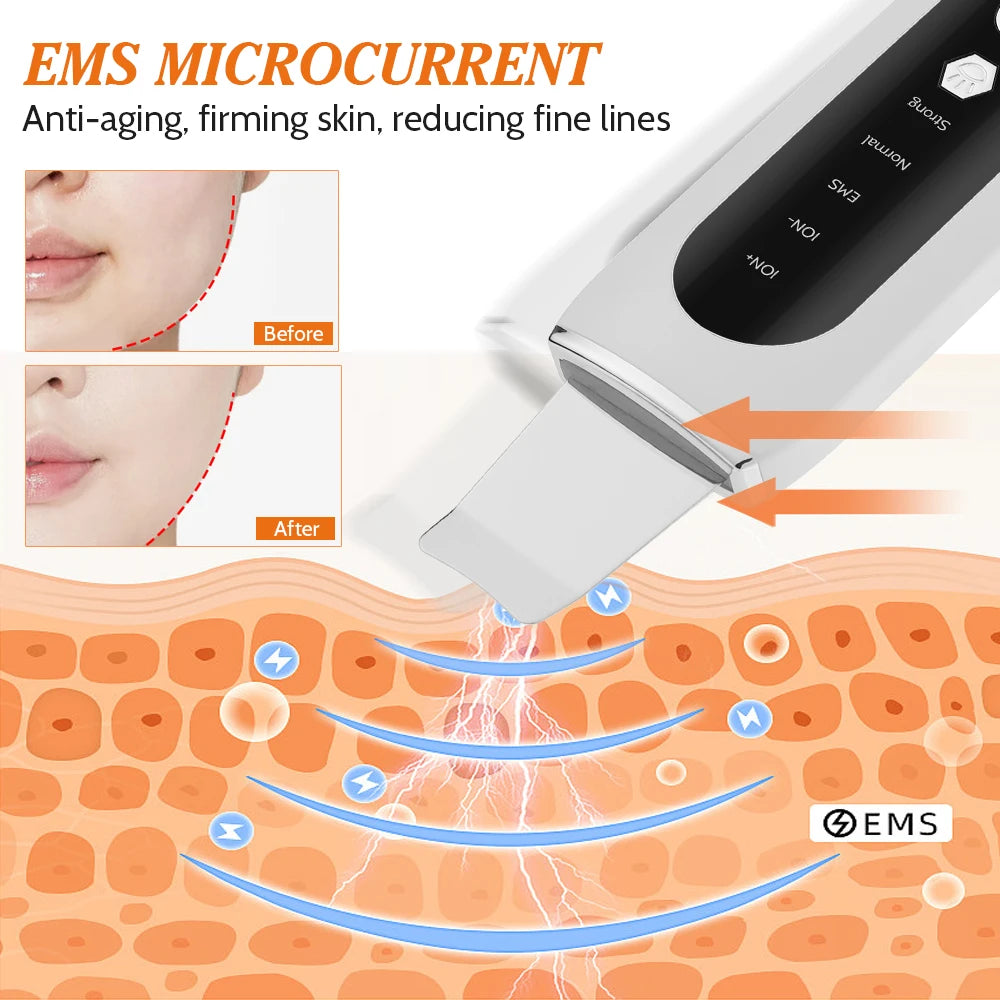 Ultrasonic Ion Skin Cleaner