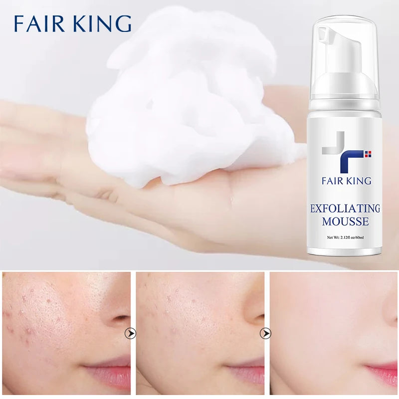 FAIR KING Exfoliating Mousse