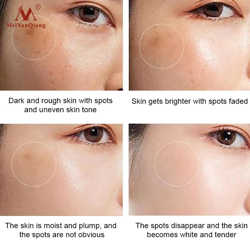 MeiYanQiong Whitening Bright Skin Cream