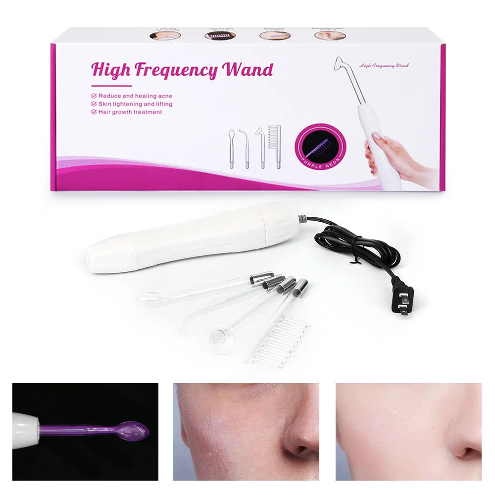 4-in-1 Portable High Frequency Facial Wand