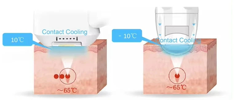 Semiconductor ICE Skin Rejuvenation Machine